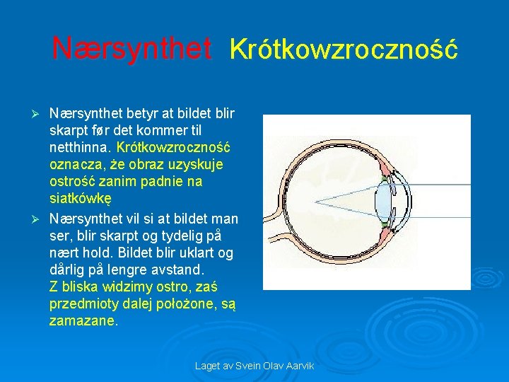 Nærsynthet Krótkowzroczność Nærsynthet betyr at bildet blir skarpt før det kommer til netthinna. Krótkowzroczność