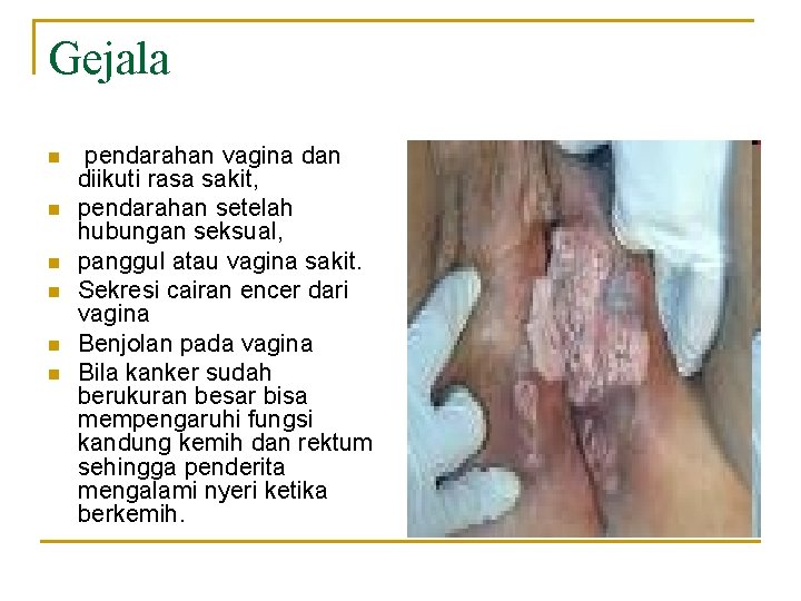 Gejala n n n pendarahan vagina dan diikuti rasa sakit, pendarahan setelah hubungan seksual,