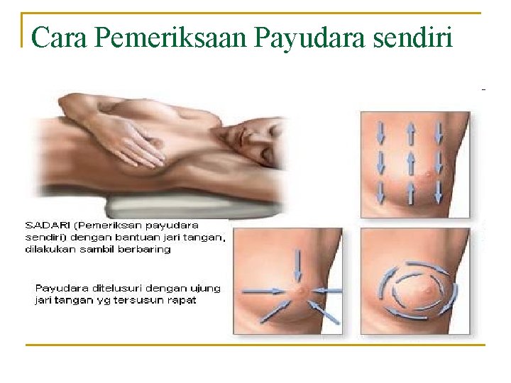 Cara Pemeriksaan Payudara sendiri 