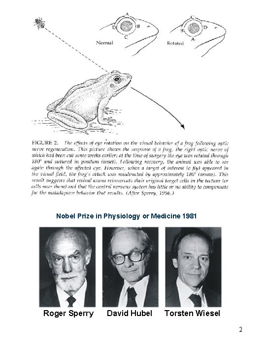 Nobel Prize in Physiology or Medicine 1981 Roger Sperry David Hubel Torsten Wiesel 2