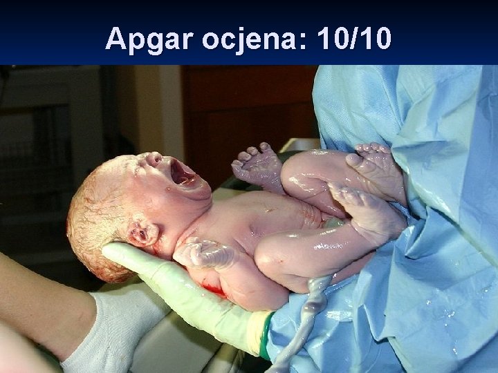 Apgar ocjena: 10/10 