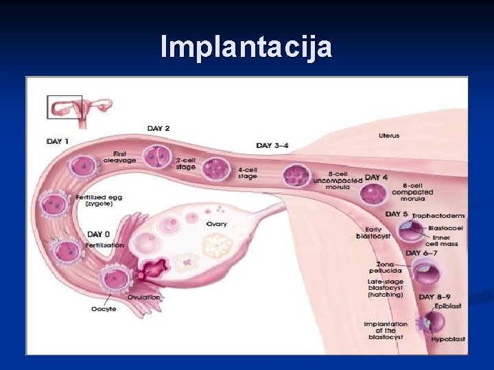 Implantacija 