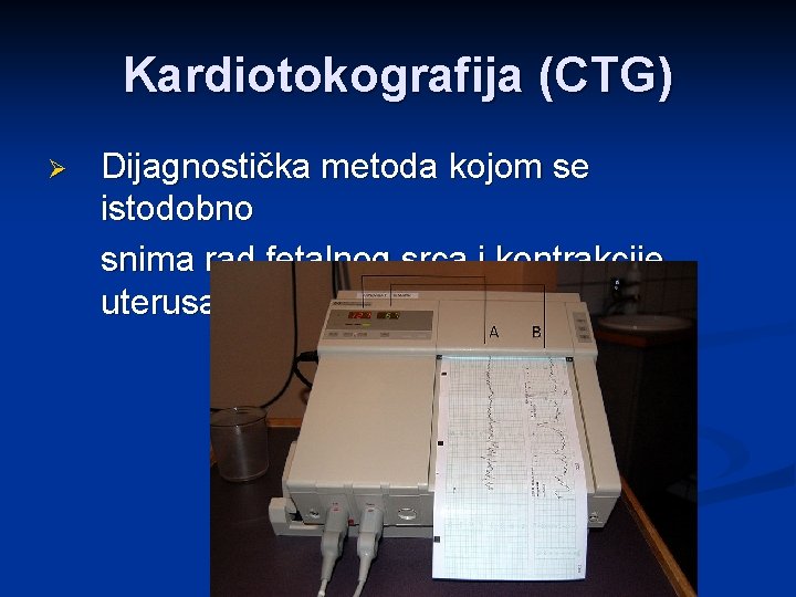 Kardiotokografija (CTG) Ø Dijagnostička metoda kojom se istodobno snima rad fetalnog srca i kontrakcije