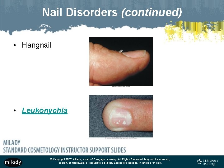 Nail Disorders (continued) • Hangnail • Leukonychia © Copyright 2012 Milady, a part of