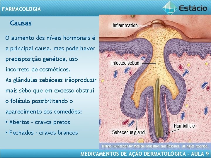 FARMACOLOGIA Causas O aumento dos níveis hormonais é a principal causa, mas pode haver