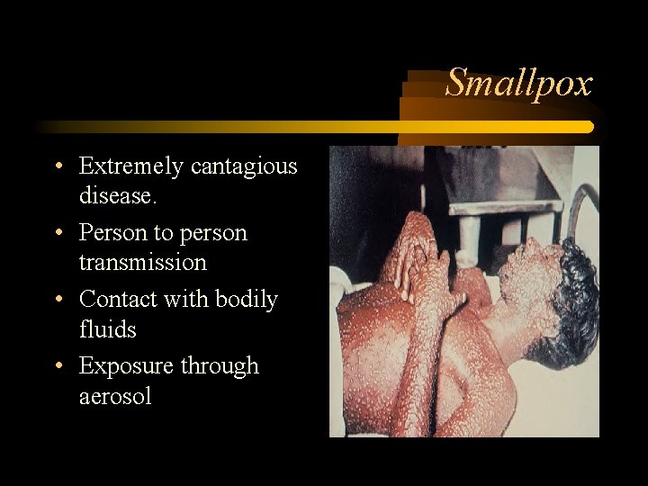 Smallpox • Extremely cantagious disease. • Person to person transmission • Contact with bodily