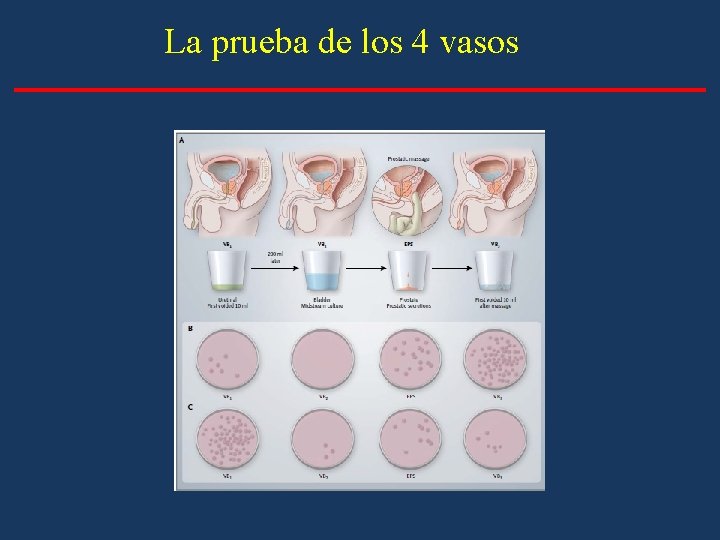La prueba de los 4 vasos La prueba de los 4 vasos