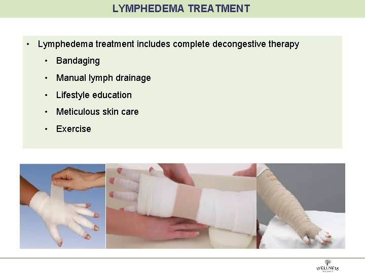 LYMPHEDEMA TREATMENT • Lymphedema treatment includes complete decongestive therapy • Bandaging • Manual lymph