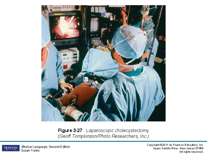 Figure 3 -27 Laparoscopic cholecystectomy (Geoff Tompkinson/Photo Researchers, Inc. ) Medical Language, Second Edition