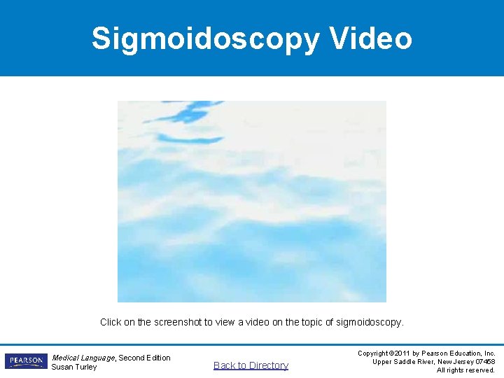 Sigmoidoscopy Video Click on the screenshot to view a video on the topic of