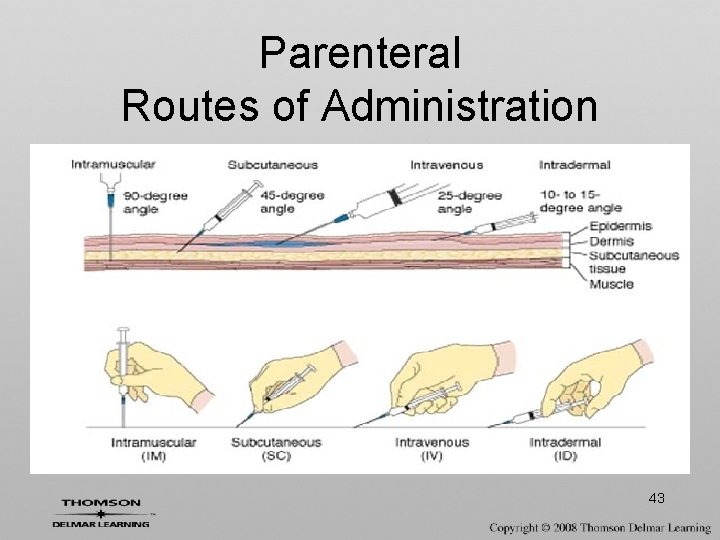 Parenteral Routes of Administration 43 Parenteral Routes of Administration 43