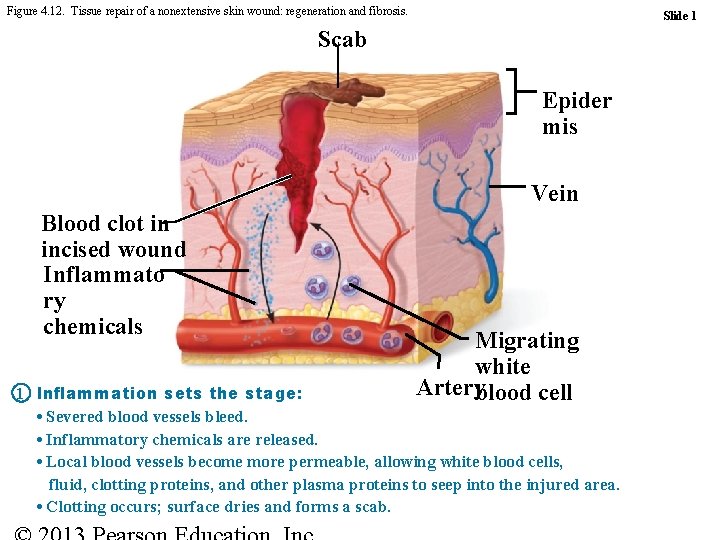 Figure 4. 12. Tissue repair of a nonextensive skin wound: regeneration and fibrosis. Slide