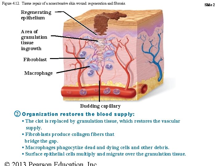 Figure 4. 12. Tissue repair of a nonextensive skin wound: regeneration and fibrosis. Regenerating