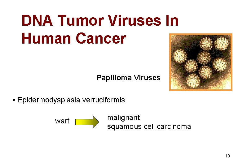 DNA Tumor Viruses In Human Cancer Papilloma Viruses • Epidermodysplasia verruciformis wart malignant squamous