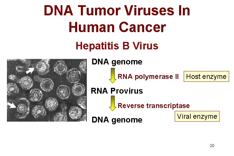 DNA Tumor Viruses In Human Cancer Hepatitis B Virus DNA genome RNA polymerase II