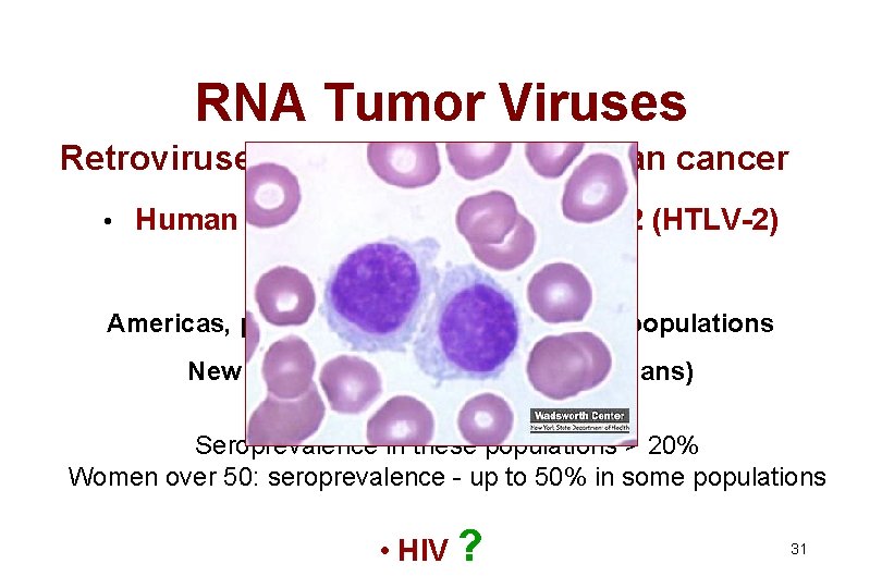RNA Tumor Viruses Retroviruses known to cause human cancer • Human T cell lymphotropic