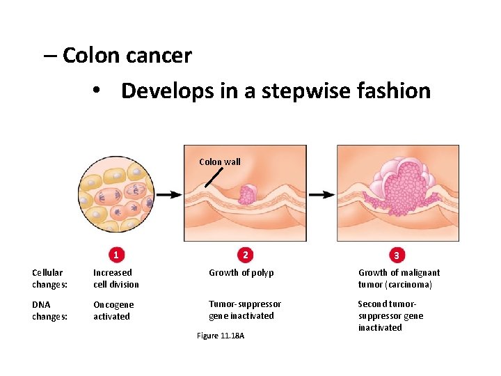 – Colon cancer • Develops in a stepwise fashion Colon wall 1 2 3