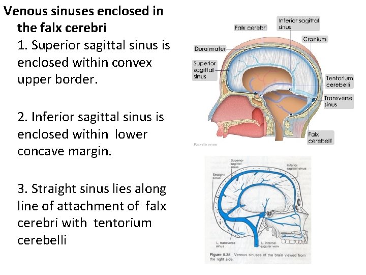 Venous sinuses enclosed in the falx cerebri 1. Superior sagittal sinus is enclosed within