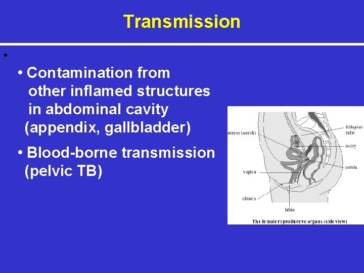 Transmission • • Contamination from other inflamed structures in abdominal cavity (appendix, gallbladder) •
