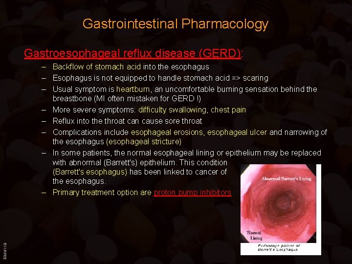 Gastrointestinal Pharmacology Gastroesophageal reflux disease (GERD): BIMM 118 – Backflow of stomach acid into