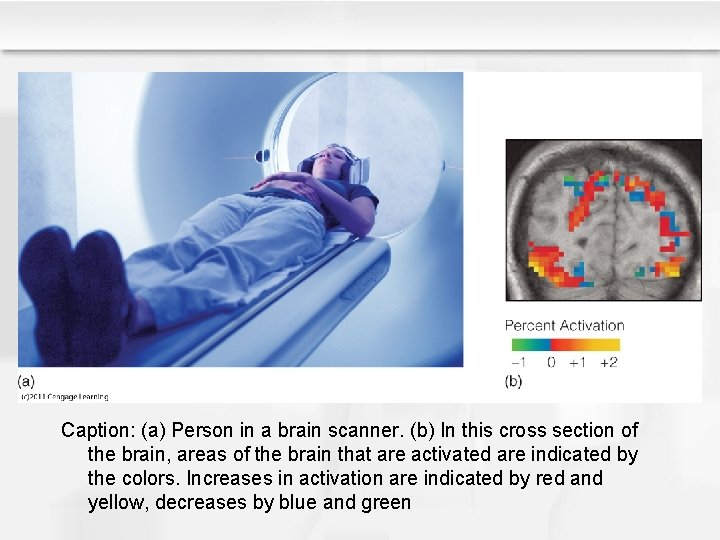 Caption: (a) Person in a brain scanner. (b) In this cross section of the