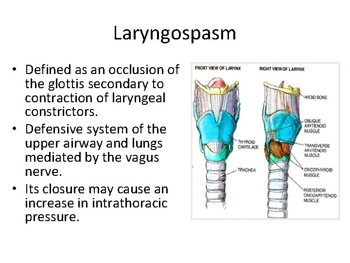 Laryngospasm • Defined as an occlusion of the glottis secondary to contraction of laryngeal