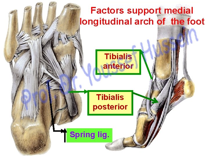 Factors support medial longitudinal arch of the foot Tibialis anterior Tibialis posterior Spring lig.