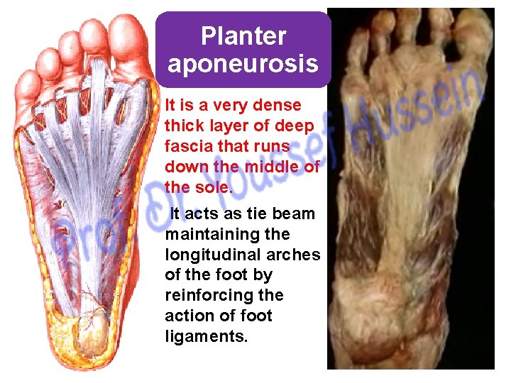 Planter aponeurosis It is a very dense thick layer of deep fascia that runs