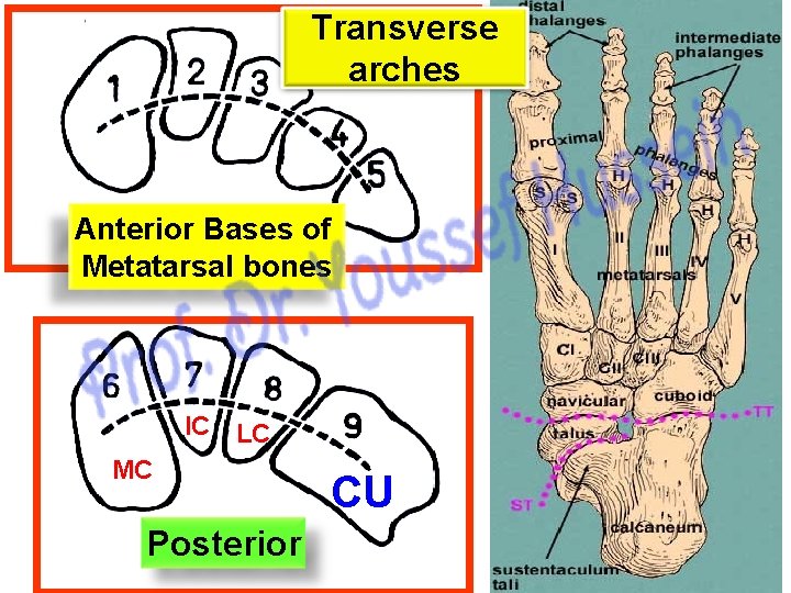 Transverse arches Anterior Bases of Metatarsal bones IC LC MC Posterior CU 