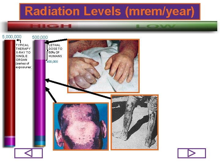 Radiation Levels (mrem/year) 5, 000 500, 000 TYPICAL THERAPY X-RAY TO SINGLE ORGAN (series