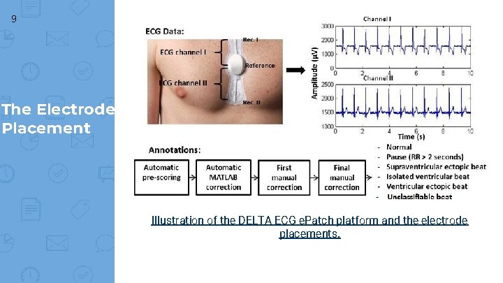 9 The Electrode Placement Illustration of the DELTA ECG e. Patch platform and the