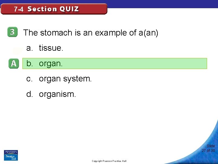 7 -4 The stomach is an example of a(an) a. tissue. b. organ. c.