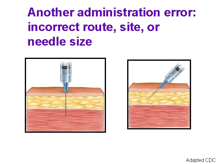 Another administration error: incorrect route, site, or needle size Adapted CDC 