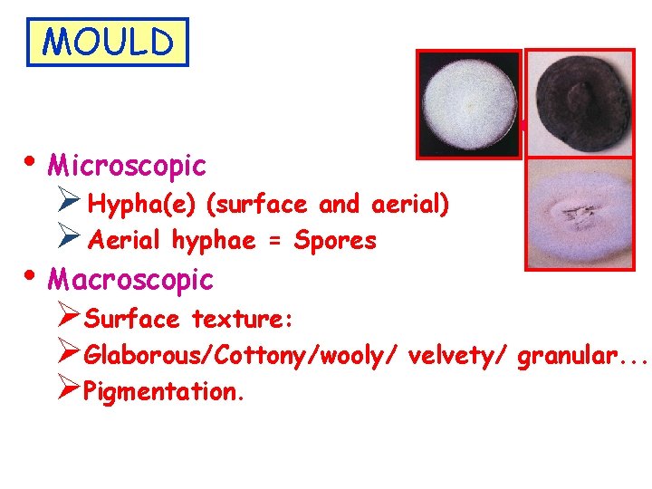 MOULD • Microscopic Multicellular • Ø Hypha(e) (surface and aerial) Ø Aerial hyphae =