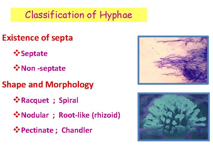 Classification of Hyphae Existence of septa v. Septate v. Non -septate Shape and Morphology