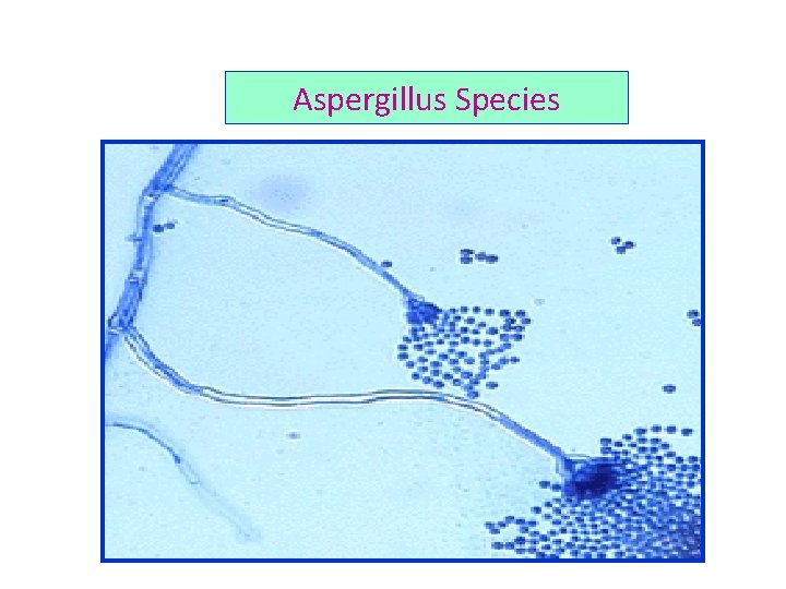 Aspergillus Species 