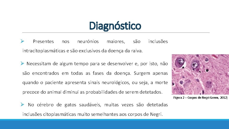 Diagnóstico Ø Presentes nos neurónios maiores, são inclusões intracitoplasmáticas e são exclusivos da doença