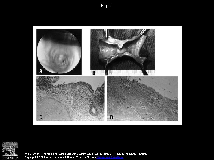 Fig. 5 The Journal of Thoracic and Cardiovascular Surgery 2002 123153 -160 DOI: (10.