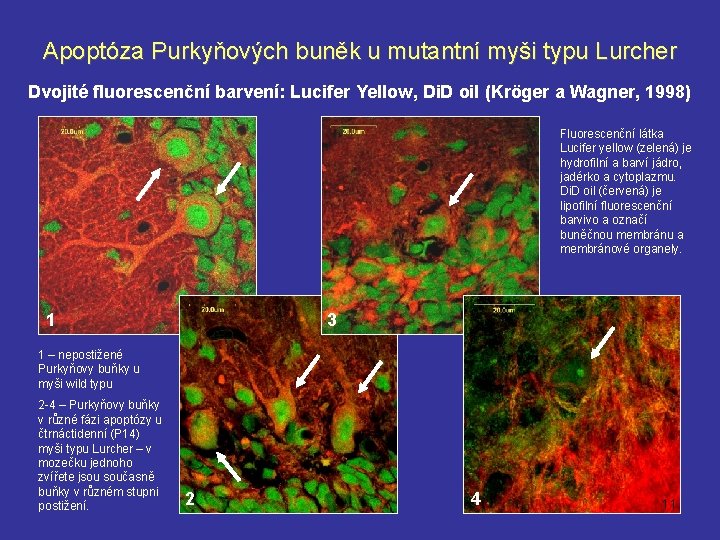 Apoptóza Purkyňových buněk u mutantní myši typu Lurcher Dvojité fluorescenční barvení: Lucifer Yellow, Di.