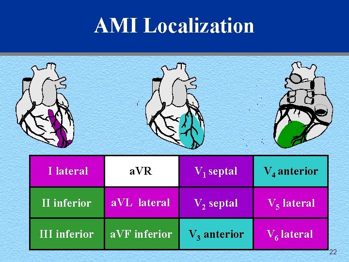 AMI Localization I lateral a. VR V 1 septal V 4 anterior II inferior