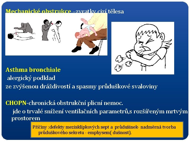 Mechanické obstrukce –zvratky, cizí tělesa Asthma bronchiale alergický podklad ze zvýšenou dráždivostí a spasmy