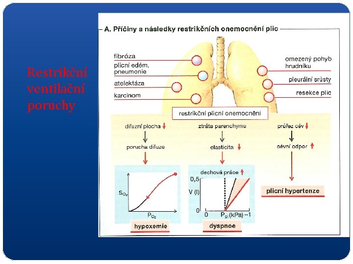Restrikční ventilační poruchy 