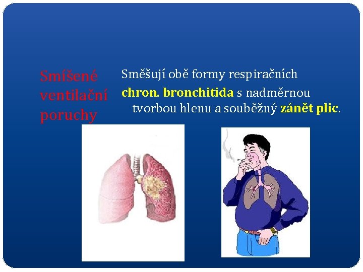 Smíšené Směšují obě formy respiračních ventilační chron. bronchitida s nadměrnou tvorbou hlenu a souběžný