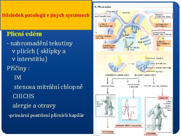 Důsledek patologií v jiných systémech Plicní edém - nahromadění tekutiny v plicích ( sklípky