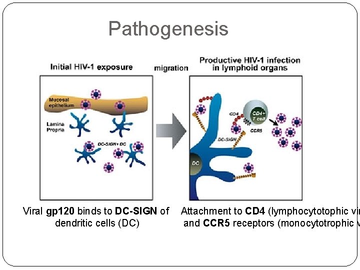 Pathogenesis Viral gp 120 binds to DC-SIGN of dendritic cells (DC) Attachment to CD