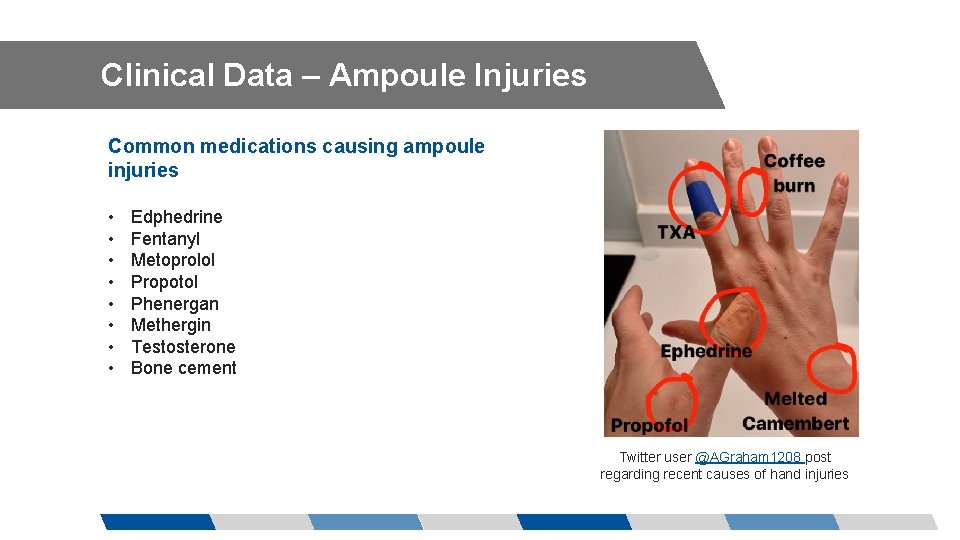 Clinical Data – Ampoule Injuries Common medications causing ampoule injuries • • Edphedrine Fentanyl