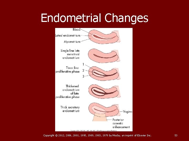 Endometrial Changes Copyright © 2012, 2006, 2001, 1995, 1989, 1983, 1978 by Mosby, an