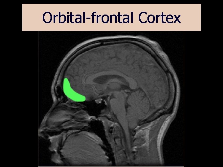 Orbital-frontal Cortex 