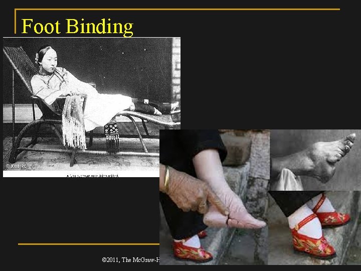 Foot Binding © 2011, The Mc. Graw-Hill Companies, Inc. All Rights Reserved. 19 