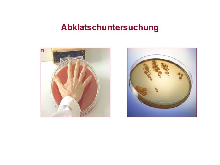 Abklatschuntersuchung 